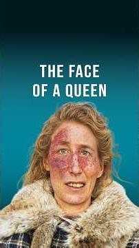 The Iron Age Queen With a Facial Deformity #history #archaeology