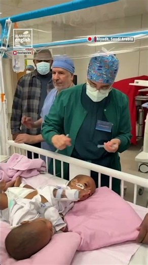 74th Conjoined Twins Separation Surgery Begins in Saudi Arabia