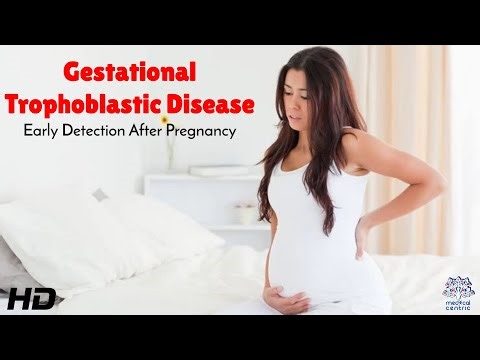 Gestational Trophoblastic Disease Early Detection After Pregnancy : A Complete Health Guide