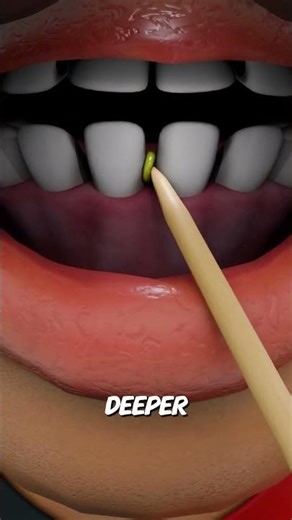 Stop Using Toothpicks RIGHT NOW! 🦷⚠️ #healthtips