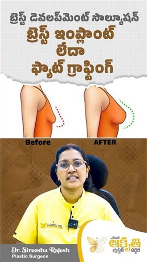Breast Augmentation Explained 💎 | Implants vs Fat Grafting DR;SIREESHA RAJESH BEST DOCTOR NELLORE