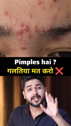 Pimple Mistakes | How to Remove Pimples From Face #shorts #pimples #skincare