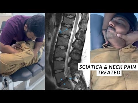 Chiropractic treatment for sciatica and neck pain | Sciatica treatment without surgery pain relief
