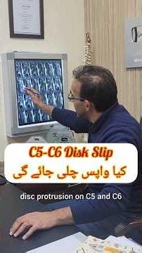C5–C6 Disk Slip ❌ Doesn’t Go Back? Then Why Does the Pain Go Away ?