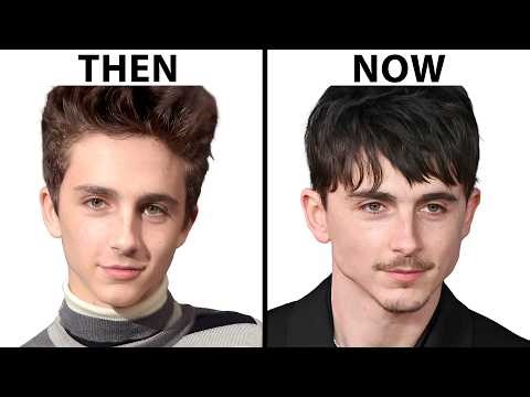 Plastic Surgeon Reacts To Timothee Chalamet's NEW FACE