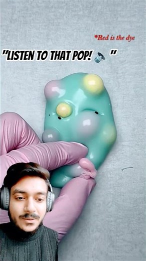 Wait for the RED Explosion! 🌋🔥 #pimplepopping