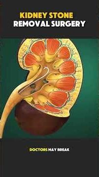How Kidney Stone Removal Surgery Is Performed | Step-by-Step explained #medicaleducation