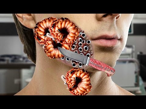 ASMR Man Cheek Treatment Insects, worms & Bees Cleaning | severely injured | Unmute asmr