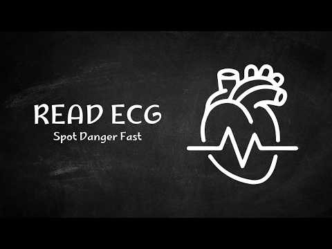 ECG Basics & Rhythm Recognition | Nursing Guide Made Simple