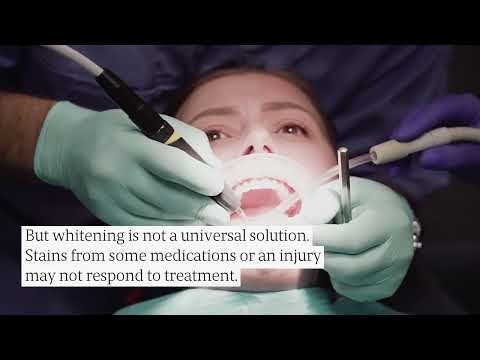 Nottingham Teeth Whitening: Real Costs, Rules & What to Expect