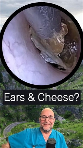 Ears & Cheese? Full video in link below
