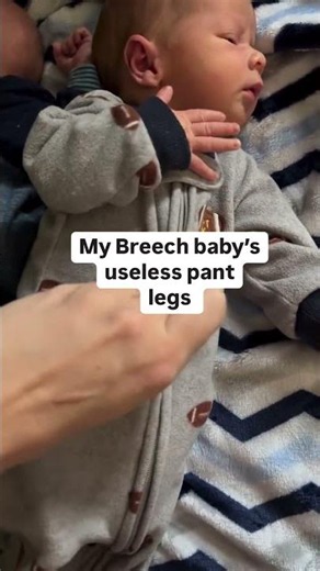 The Unexpected Struggle: Breech Twin A and the Mystery of Useless Pant Legs