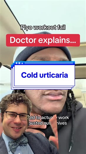 What are cold induced hives? What is cold induced urticaria? #rash #allergies #cold #tiktokdoc @lordkamar