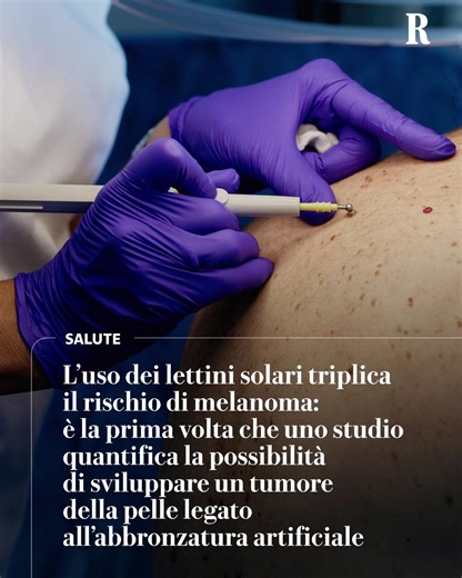 Che l’abbronzatura da lampade sia correlata a un aumento del rischio di melanoma, il tumore della pelle più aggressivo, è noto da molti anni. Ma ora uno studio statunitense quantifica esattamente di quanto aumenti tale rischio: quasi tre volte. E misura, per la prima volta, anche il tasso di mutazioni potenzialmente pericolose che si verificano nel Dna delle cellule della cute esposta alla luce Uv artificiale: è doppio rispetto al tasso di mutazioni di chi non ha mai provato un lettino solare. L
