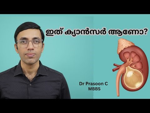 Saw “Cyst” in Your Scan? 😱 Don’t Panic! Kidney Cyst Explained