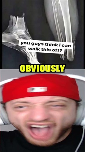 Can You Walk This Off... #shorts #short #memes #meme
