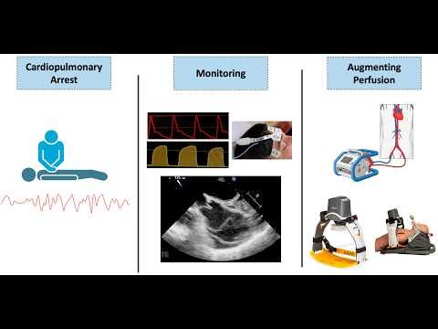 Monitoring During Resuscitation Patient Resuscitation