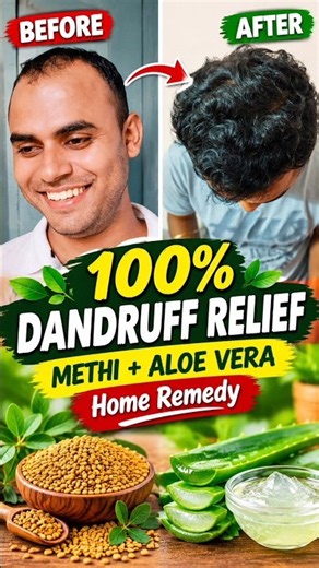 Natural Dandruff Treatment At Home l Dandruff + Itchy Scalp? 🌿 Try This Natural Routine”