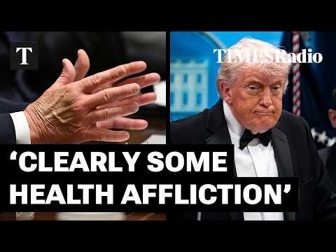 Trump 'Clearly Has Some Health Affliction' That The Whitehouse Won't Talk About | Aaron Rupar