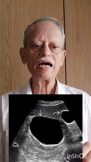 Ultrasound scan report shows Simple renal cortical cyst. Should you worry?