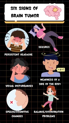 Six signs of a brain tumor