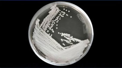 Who is most and least at risk from Candida auris?