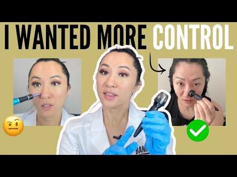Why I Created The Microneedling Tool Banisher 3.0 for Acne Scars