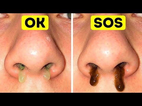 You Are Basically a Walking Mucus Factory