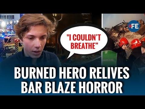 “Fireball Over My Head”: Burned Bar Hero Reveals Horror of Blaze That Left Brother in Coma