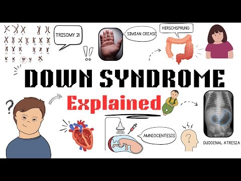 Down Syndrome Explained in 4 minutes | High Yield Concept