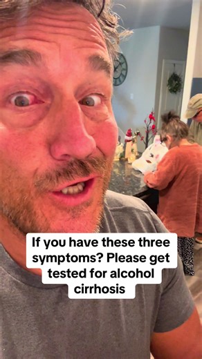 Yes, advanced alcoholic cirrhosis can simultaneously cause a fever, cause the skin and whites of the eyes to turn yellow (jaundice), and lead to various forms of eye damage my parents love what I do so they just leave me alone when I’m doing alcohol awareness, and doing all the fear mongering to save lives 🫶😍❤️