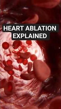 What Is a Heart Ablation? | Procedure Explained