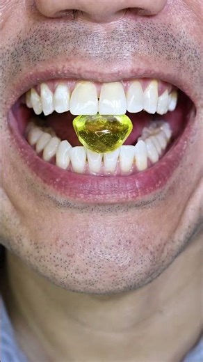 ASMR | Yellow Diamond Hard Candy 💎🍋 #DoctorTristanPeh #ASMR