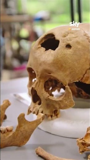 How Did This Ancient Person Die? | Digging for Britain