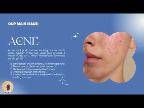 Interesting New Research in Designing New Anti-Acne Cream