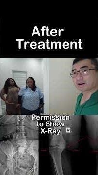 BEFORE & AFTER - Pain Focus Shockwave Therapy XRAY Katy/Fulshear Chiropractor