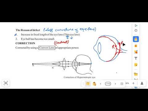 Hypermetropia and presbyopia defects in the human eye class 10 chapter human eye and colourful world