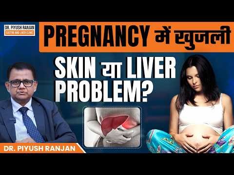 Pregnancy में Itching (Khujli) क्यों होती है? | Liver Problem in Pregnancy (IHCP)