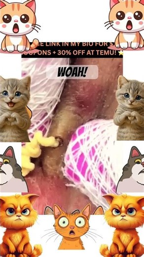 😷😷😷😷 cyst explosion!!