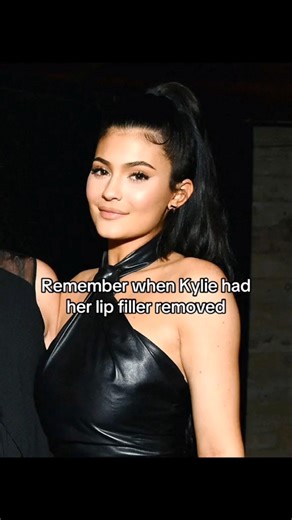 Remember when Kylie Jenner had her lip filler removed 😩