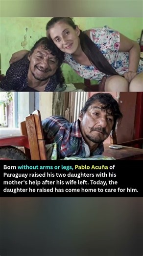 He was born without arms, and his legs never developed. 👇