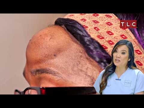Shoshana's Forehead Secret! | Dr Pimple Popper S3 E5 | TLC India