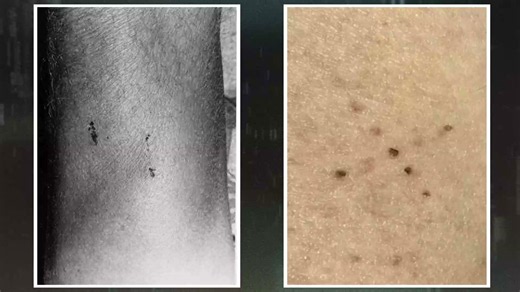 Proof of alien abduction on her skin? | The Proof Is Out There