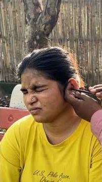 Street Ear Wax Removal ASMR 👂 | India Deep Cleaning
