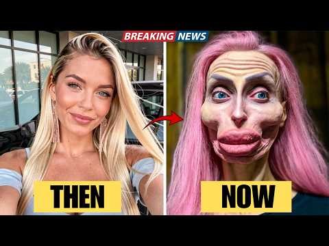 15 Hollywood Plastic Surgery Disasters That Led Stars to Lose Everything | Then and Now 2026
