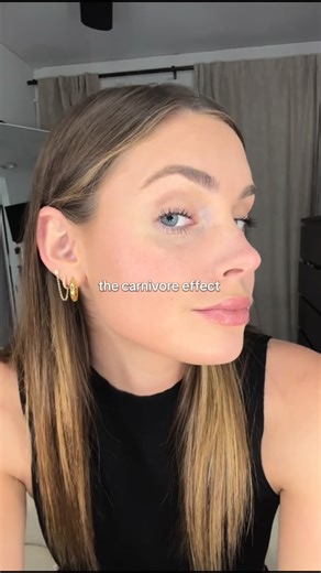 MISSMEAT on Instagram: "I used to never want to leave the house because of my acne #acne #skinjourney #carnivore"