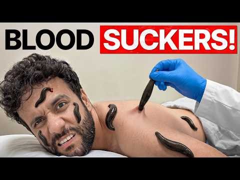 20 Deadly Leeches vs My Body! (Crazy Experiment)