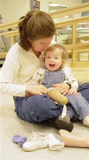 Her First Below-Knee Prosthesis in 2003 — Look at Her Now