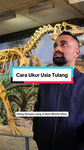 Cara Ukur Usia Tulang: 2 Kaedah Utama yang Digunakan Saintis