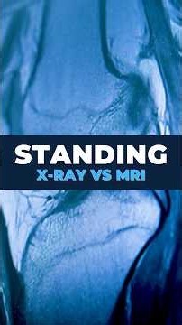 MRI vs. X-ray: Which one actually matters? #orthopedics #healthtips